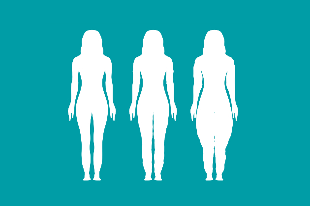 Illustration shows silhouettes of women at different stages of lipoedema 